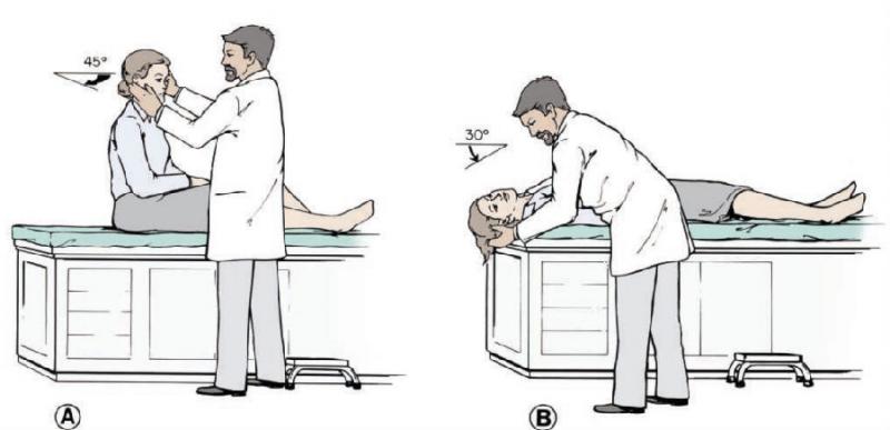 耳石症2.png 耳石症2.png