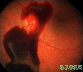 糖尿病11.jpg 糖尿病11.jpg